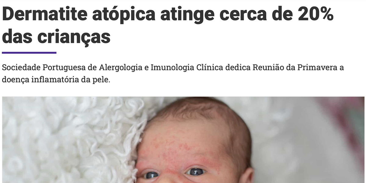 Dermatite Atópica - Noticias ao minuto 