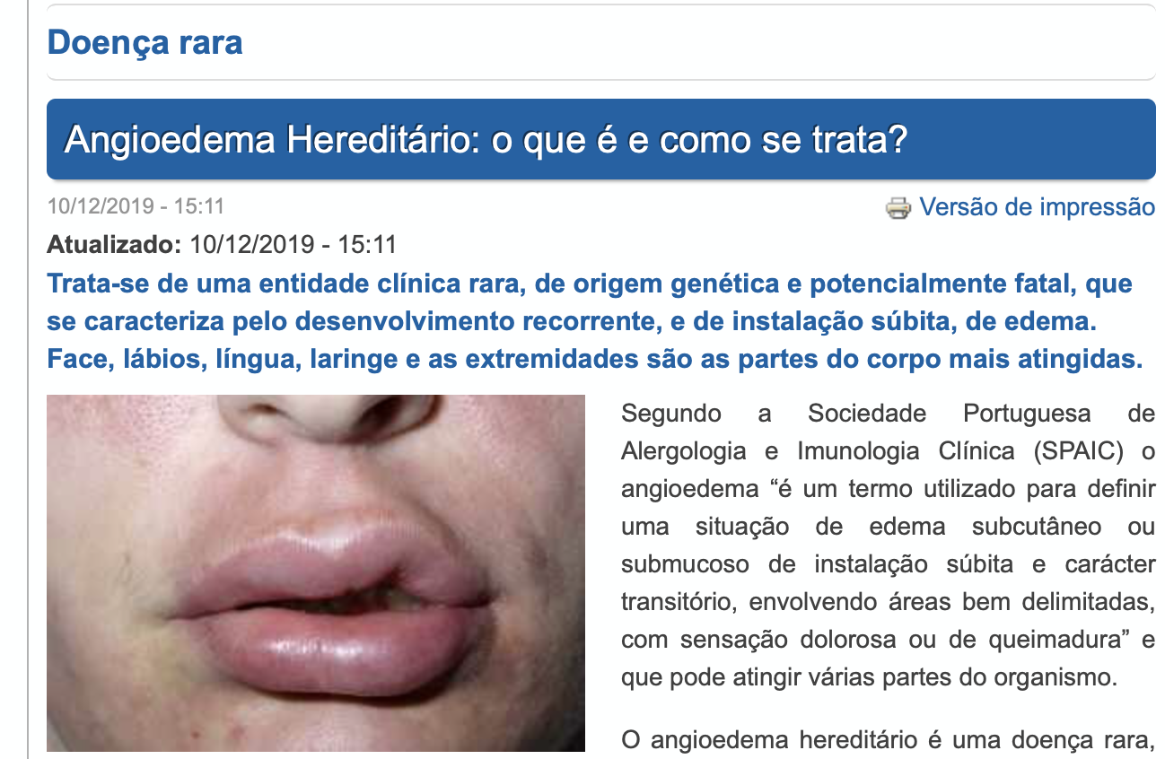 Atlas da Saúde: 10/12/19 Angioedema Hereditário - o que é e como se trata? 