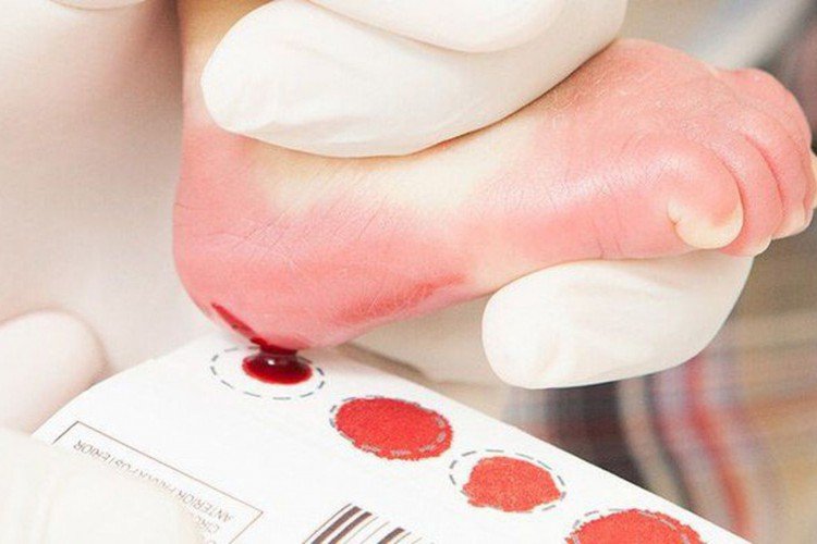 Petição: Pela inclusão da Imunodeficiência Combinada Grave no rastreio neonatal